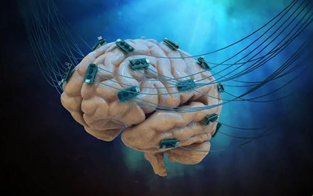 TDCS تحریک الکتریکی مغز